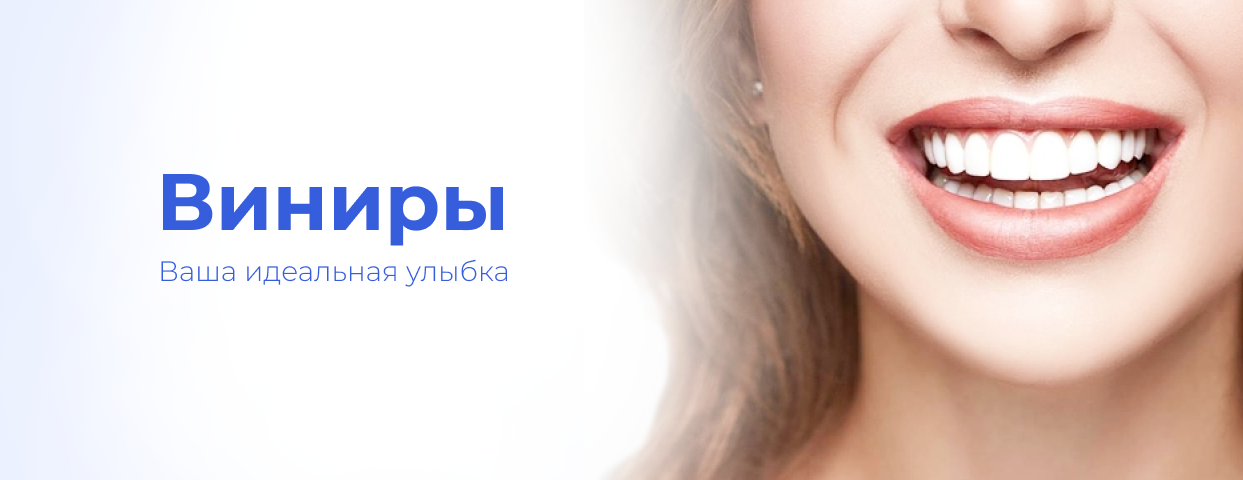 Виниры